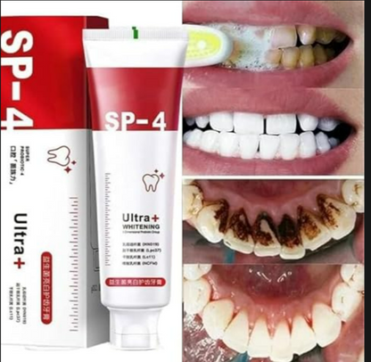 SP-4 Probiotic Whitening Toothpaste (pack of 2)